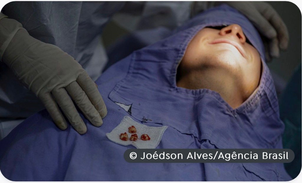 Brasil Sorridente deverá cobrir 62,5% da população em&nbsp;2024